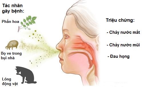Viêm mũi dị ứng dễ gây biến chứng